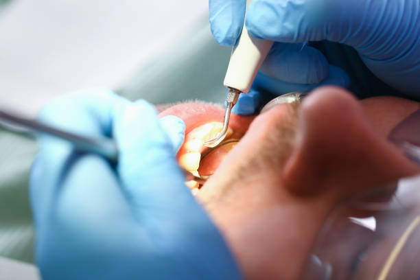 Best Dentist Open Late Near Me  in Walnut Creek, OH