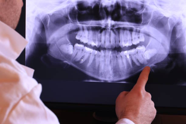 Best Urgent Tooth Repair  in Walnut Creek, OH