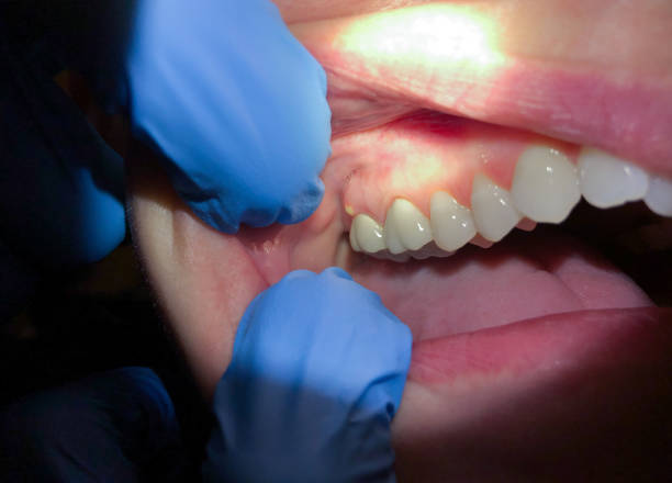 Best Emergency Gum Pain Relief  in Walnut Creek, OH