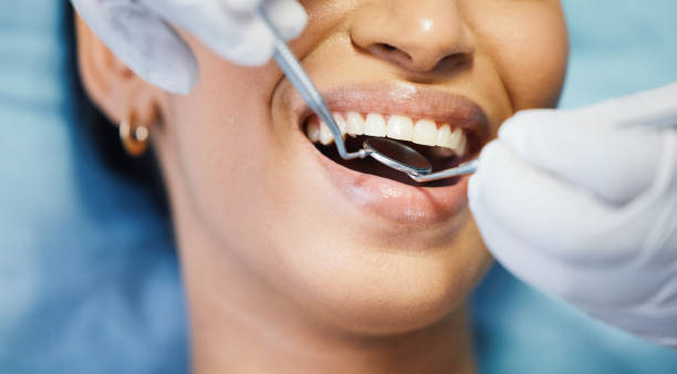 Best Broken Tooth Emergency  in Walnut Creek, OH
