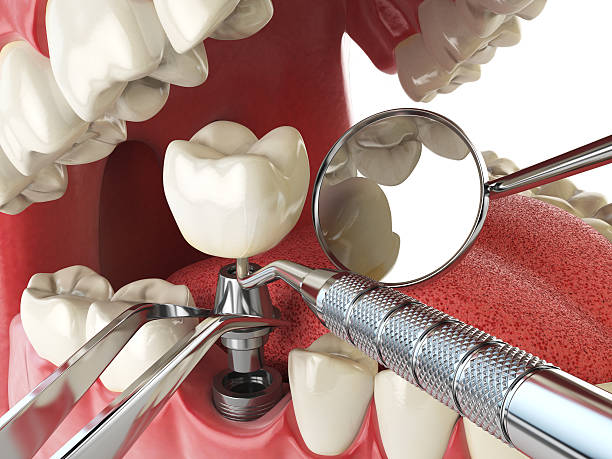 Best Emergency Dentist Near Me  in Walnut Creek, OH